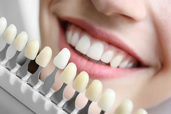 Dr. Shvarts gives you the smile of your dreams