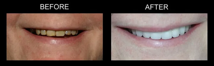 Philadelphia Dentist Smile Design