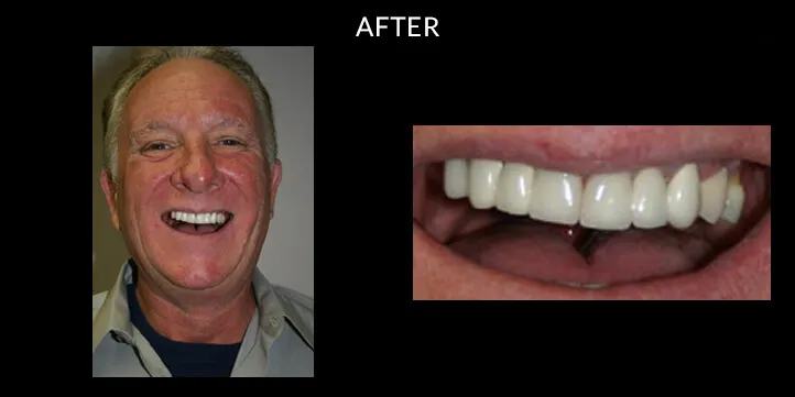 Philadelphia Dentist Smile Design